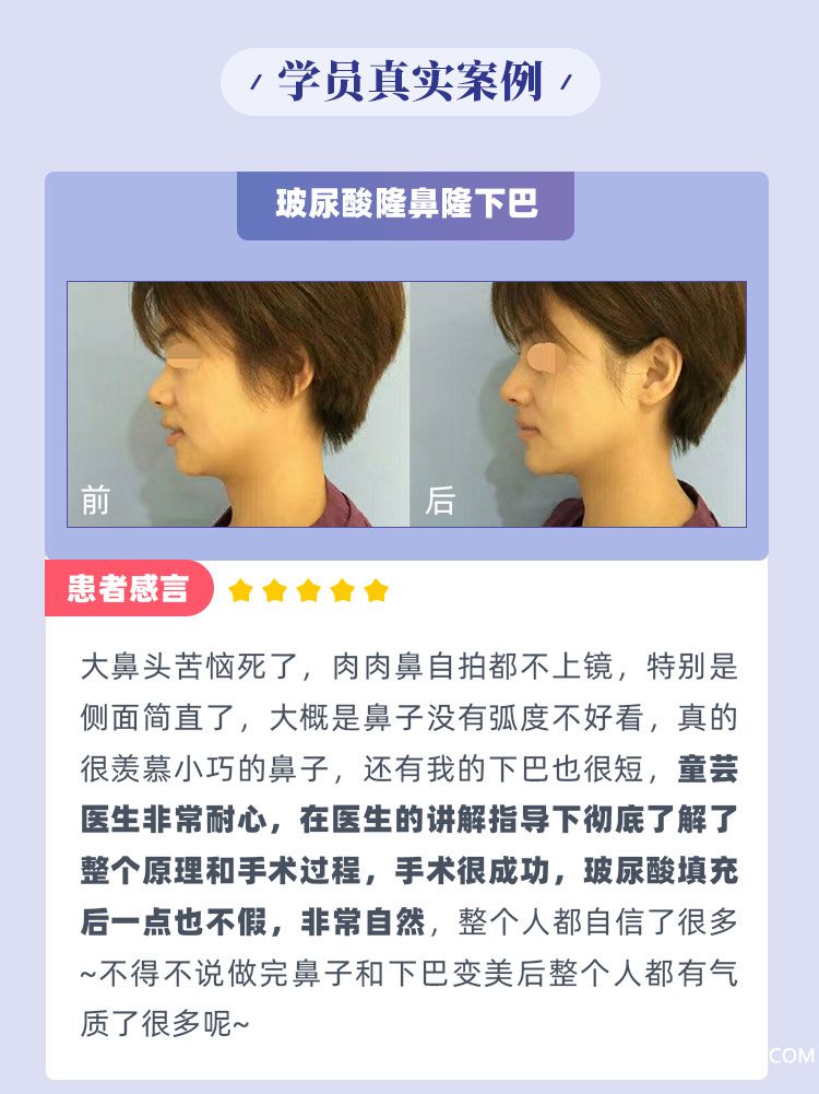 .jpg 20191024童蕓+徐捷醫(yī)生醫(yī)美課程設(shè)計_07.jpg